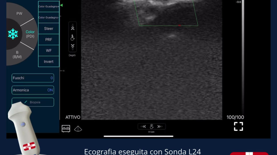 Arteria Labiale Dott Traversa 048